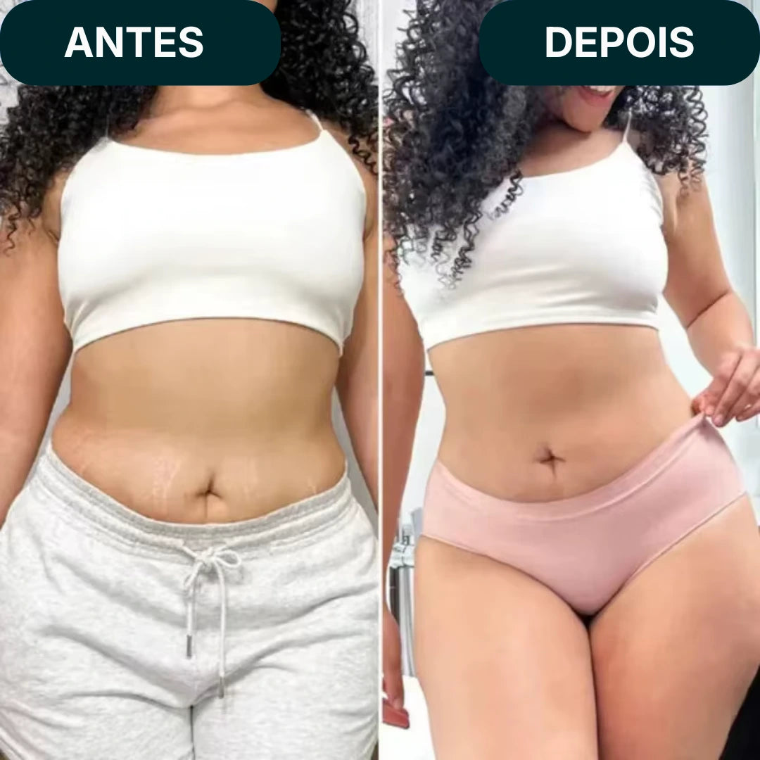 Massageador MaxConfort™  - Anticelulite e Ação Térmica!